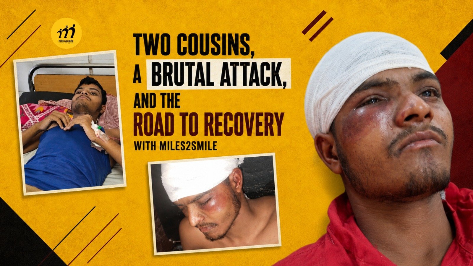 Two Cousins, a Brutal Attack and the Road to Recovery with Miles2Smile